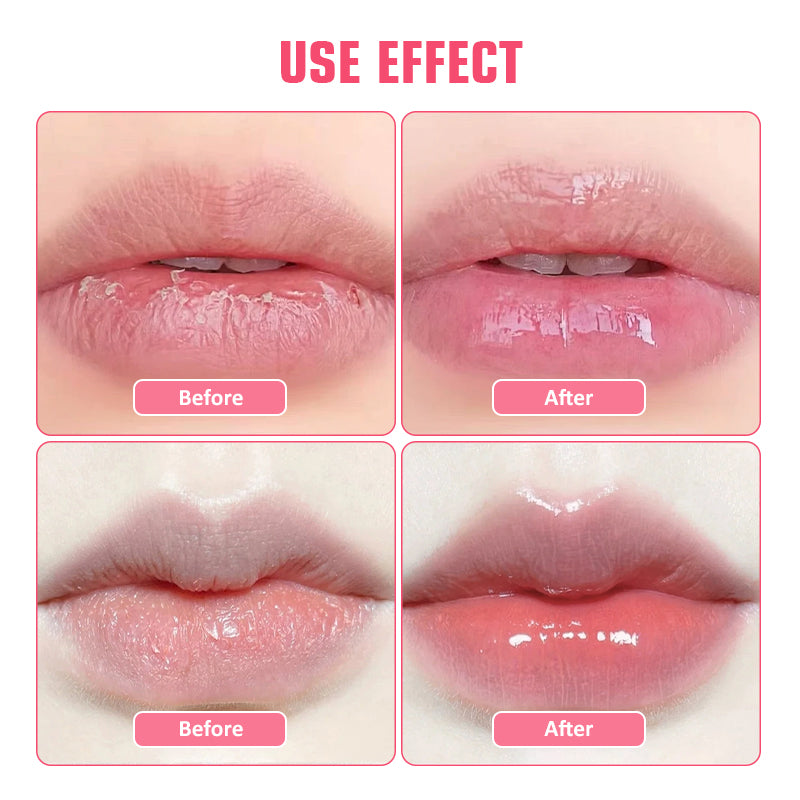 12-Pack Hydrating Collagen Lip Mask ✨ Overnight Repair & 24H Plump! 💋 Crystal Gel Patches for Lip Line Smoothing 🌟 Juicy #GlassSkinLips #LipCareHack 12-Pack Hydrating Collagen Lip Mask ✨ Overnight Repair & 24H Plump! 💋 Crystal Gel Patches for Lip Line Smoothing 🌟 Juicy #GlassSkinLips #LipCareHack